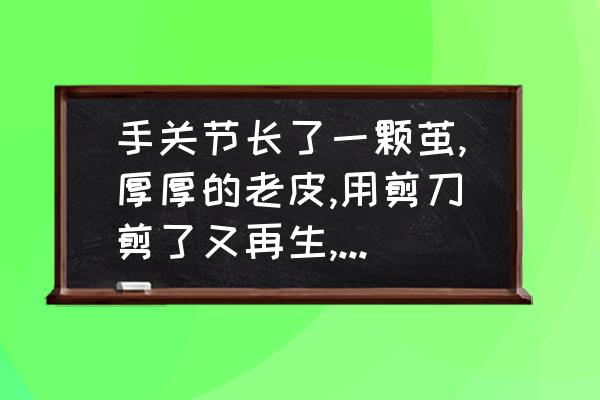 小妙方脚上老皮老茧助你轻松解决 手关节长了一颗茧,厚厚的老皮,用剪刀剪了又再生,是什么东西？